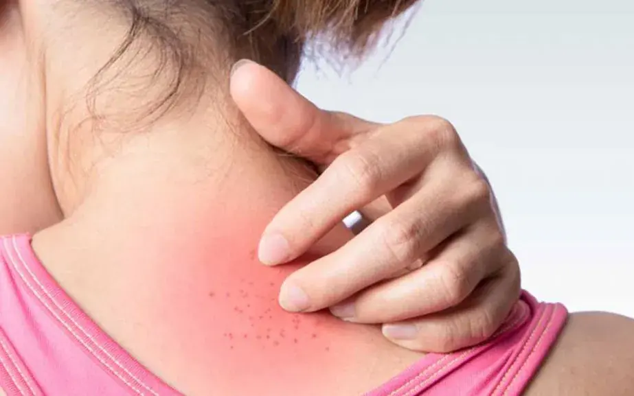 Cancer Warning Signs: 9 Areas Where Itching Could Mean Something Serious