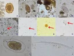 5 Raw Vegetables That May Contain Parasites — What You Should Know Before Eating Them