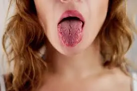 Dry Mouth Every Morning? 8 Possible Causes You Shouldn’t Ignore