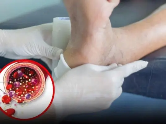 Your Feet May Be Revealing Important Clues About Your Circulation and Nerve Health