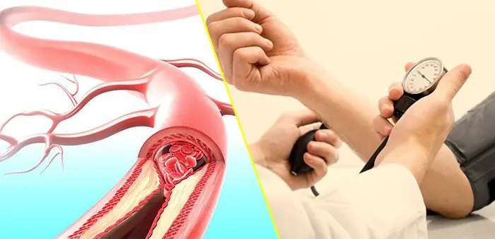 High Bl00d Pressure Patients Should Be Careful About These Morning Activities