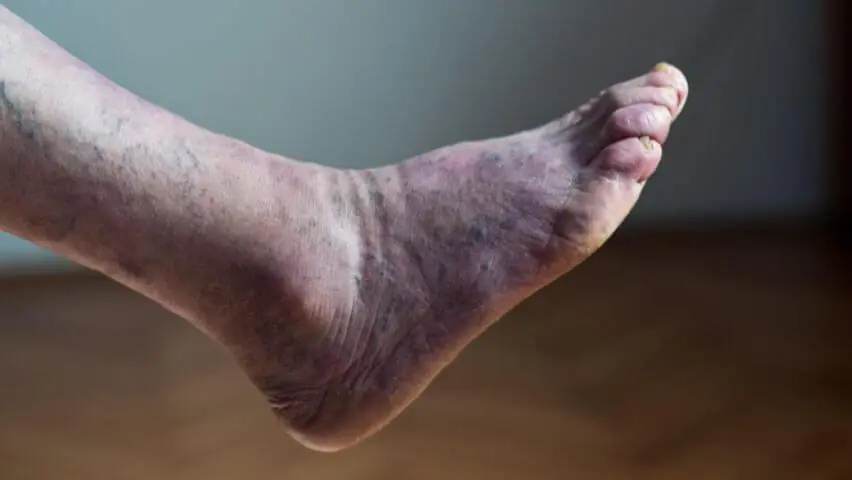 One Drink That May Help Improve Blo.od Circulation in Your Legs Naturally