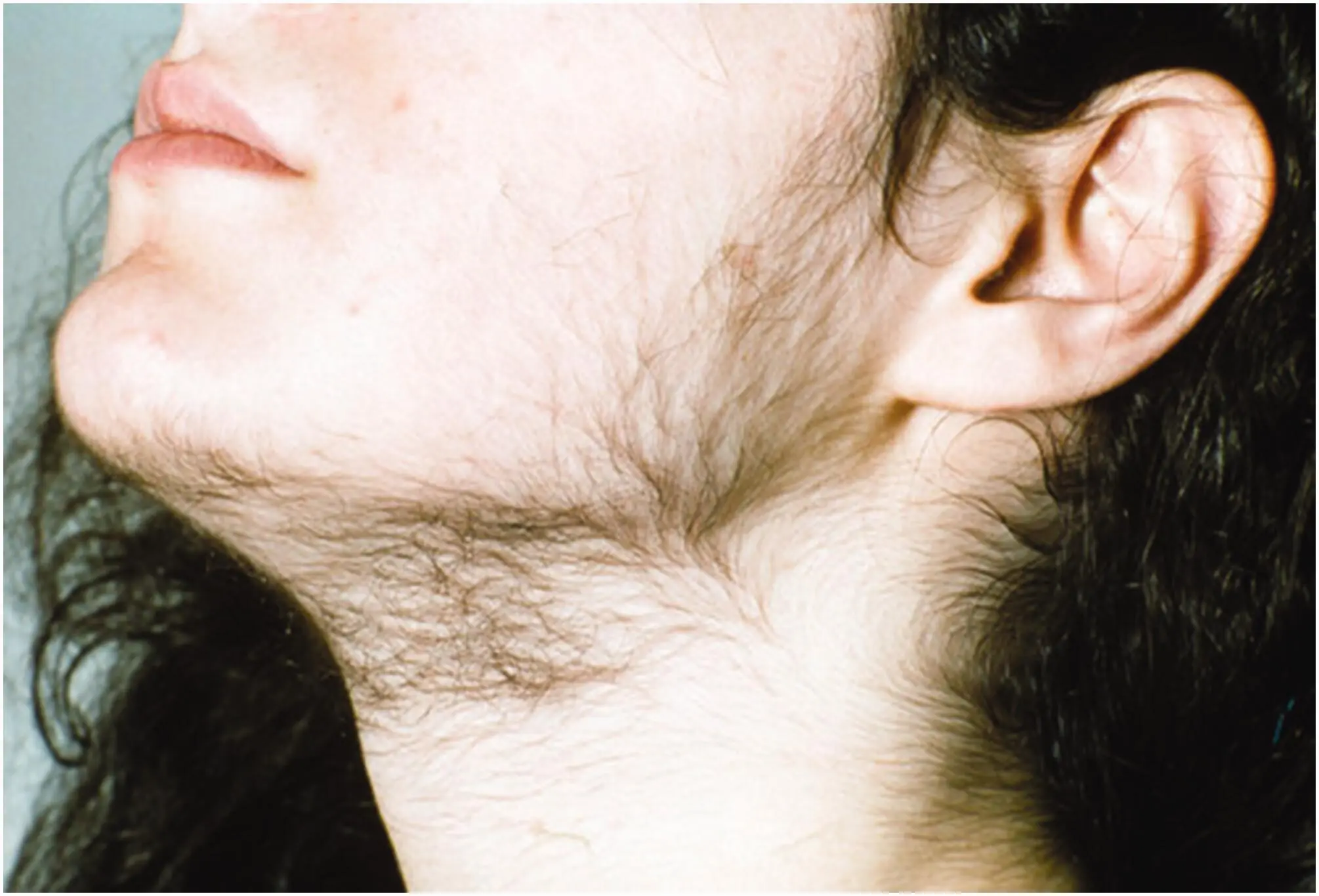 What Does Chin Hair in Women Really Mean? Experts Explain the Possible Causes