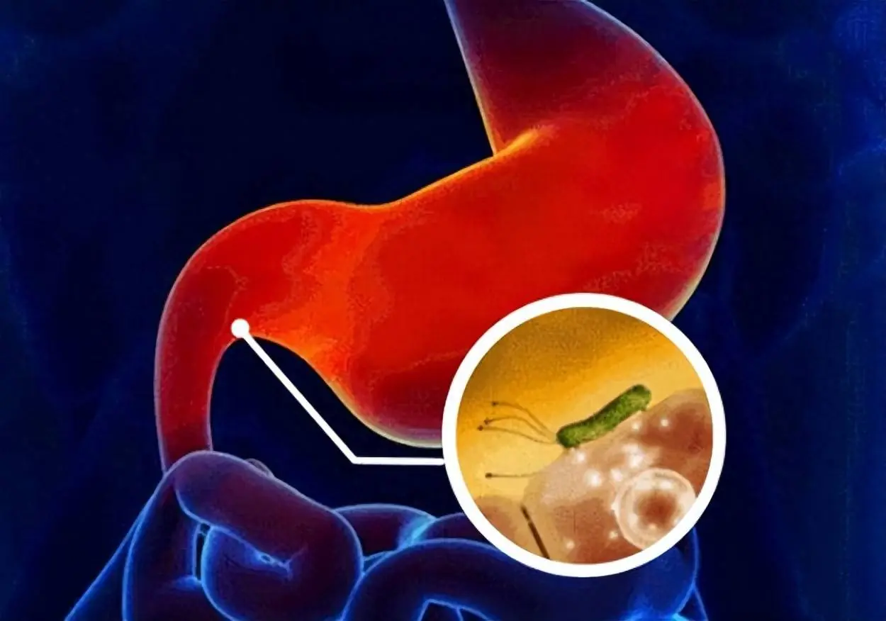 5 Early Warning Signs of Sto.mach Can.cer Many People Mistakenly Ignore as “Minor Digestive Problems”