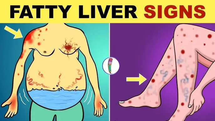 Doctors Reveal 10 Symptoms That May Signal Liver Problems