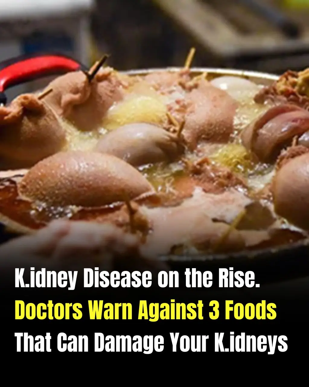These 3 Everyday Foods May Be Harder on Your Kidneys Than You Think