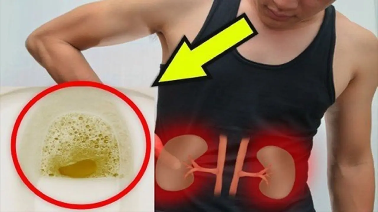 Bubbles in Your Urine? Here’s What Your Body May Be Trying to Tell You
