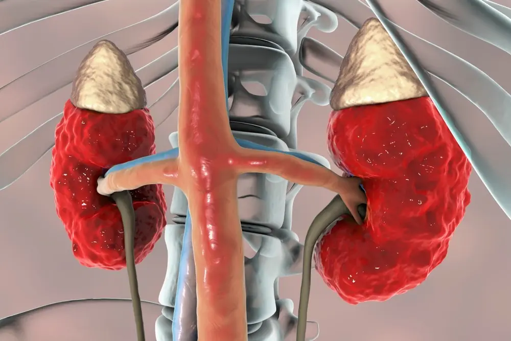 Man Collapses from Kidney Failure After Ignoring Repeated Warnings from His Wife
