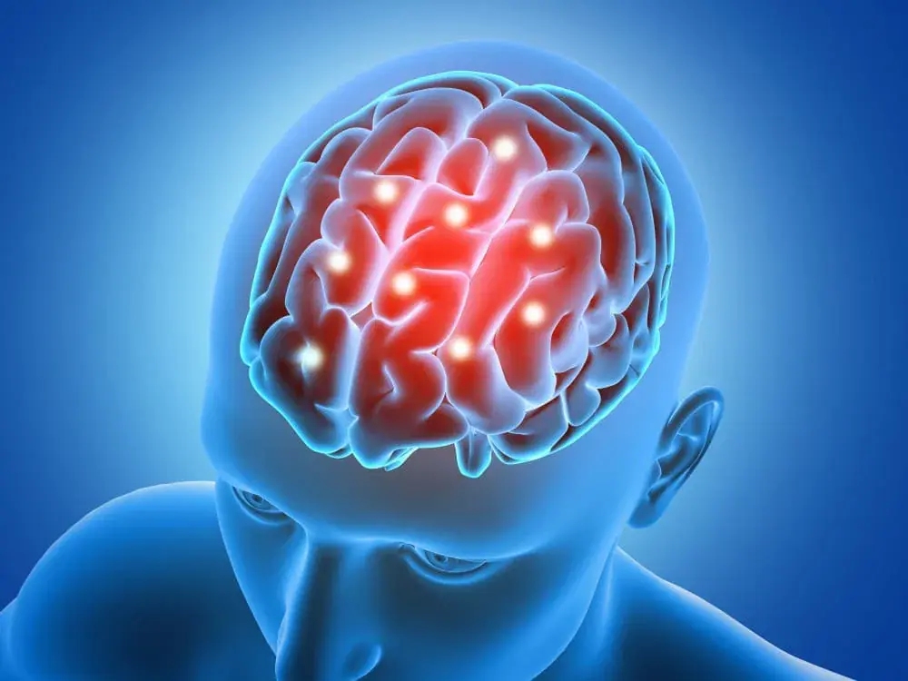 These 10 stroke symptoms may appear suddenly — and many people miss the early warning signs