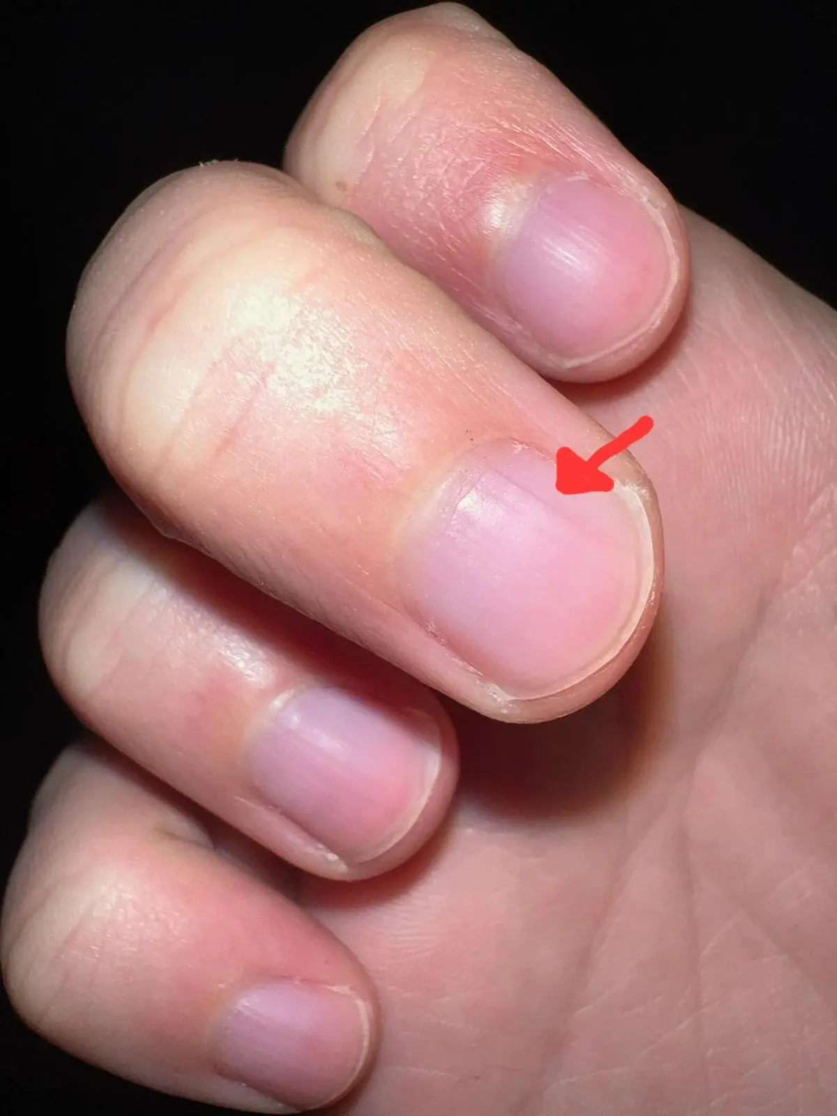 These Lines on Your Nails After 40 Could Be More Important Than You Think…