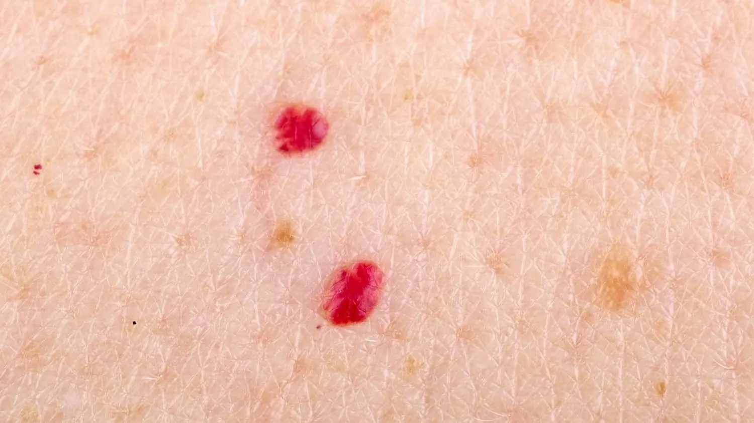 Red Dots Appearing on Your Skin? Don’t Panic — But Don’t Ignore Them Either