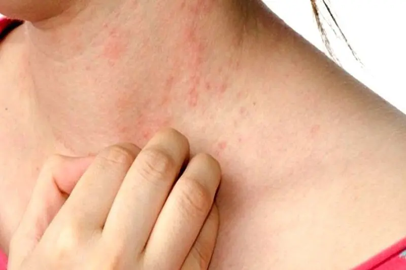 These 9 Types of Persistent Itching May Be Warning Signs of Serious Health Problems - Including Can.cer