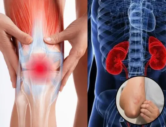 8 Warning Signs of Kidney Failure You Should Never Ignore