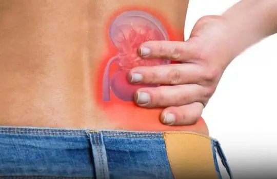4 Drinks That May Help Support Kidney Health and Reduce the Risk of Kidney Stones