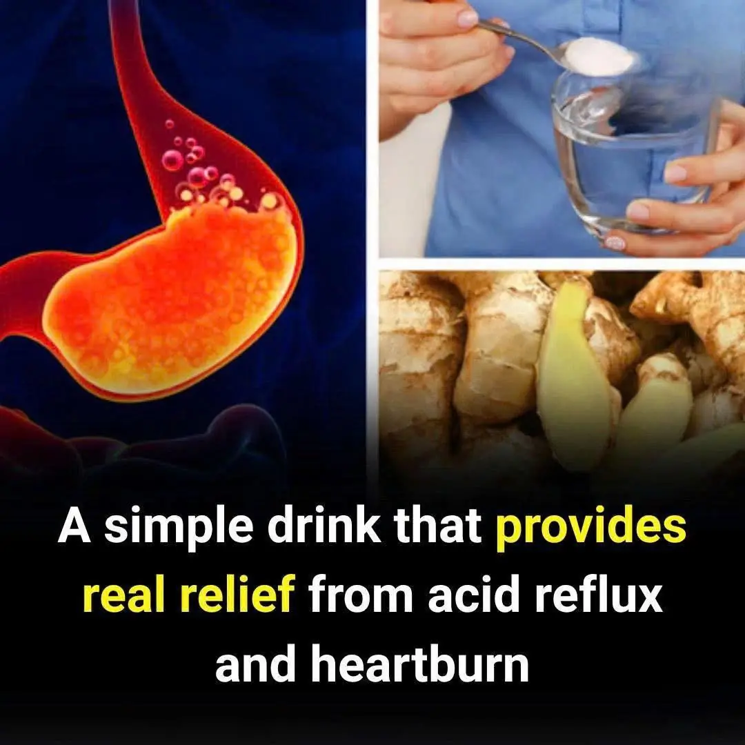 Struggling With Heartburn? This Simple Drink May Help Calm Acid Reflux Naturally