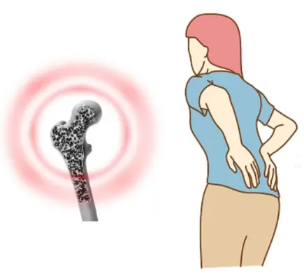 When the kidneys start to malfunction, waste products build up in the blood stream, causing various symptoms