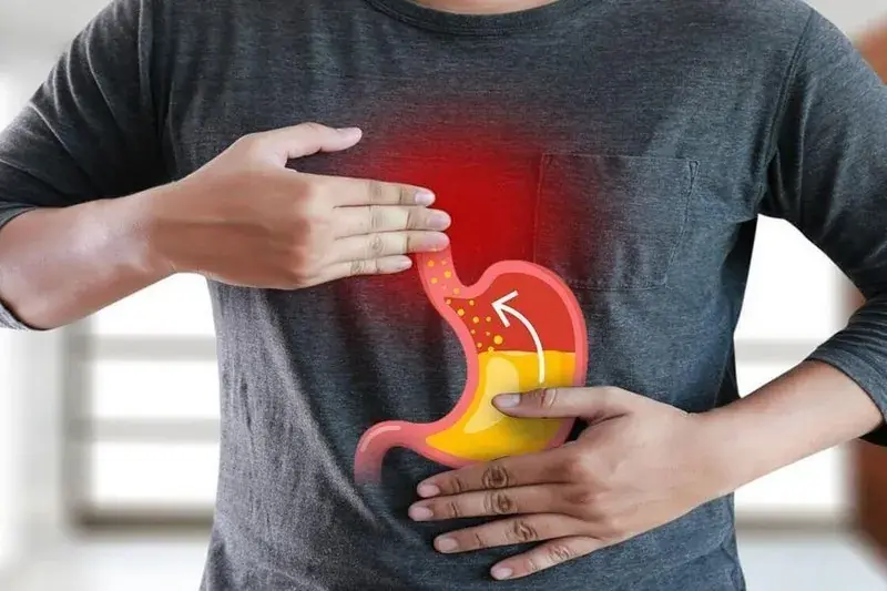 What If These 3 Simple Habits Could Naturally Help Reduce Acid Reflux?