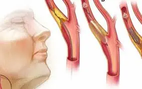 Protect Your Heart: 6 Evidence-Based Ways to Support Healthy Arteries