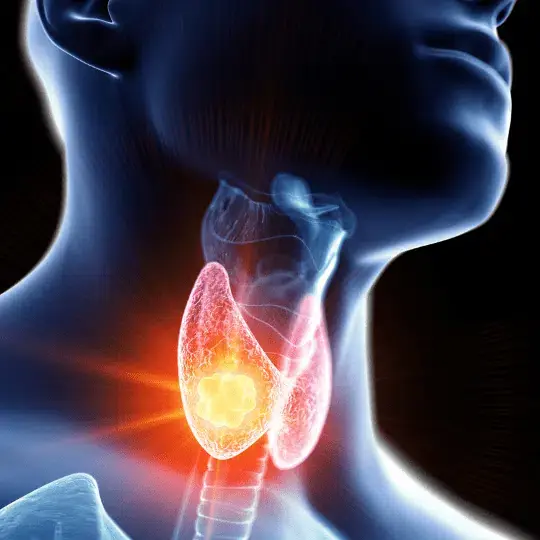 Hypothyroidism and Nutrition: Foods May Affect More Than You Realize
