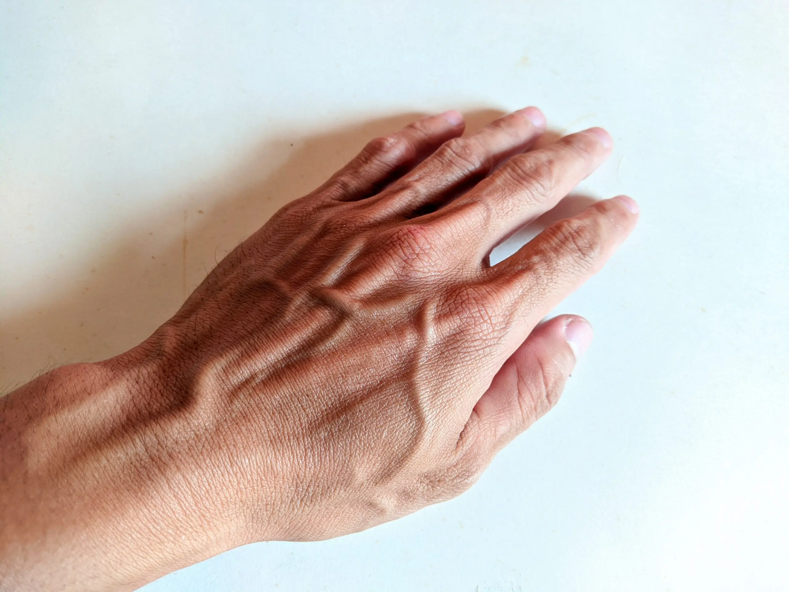 You Might Be Surprised What Visible Veins Can Reveal About Your Body