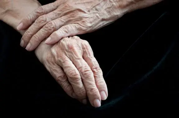 If Your Veins Suddenly Become More Visible or Change Color, It May Be Worth Paying Attention