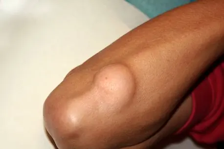 A Lump Like This May Not Be Random — Here’s What Could Trigger It