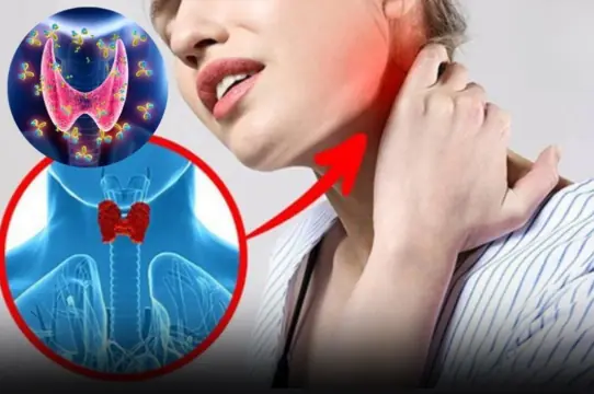 5 Early Warning Signs of Thyroid Cancer That Are Often Easy to Overlook