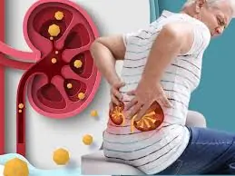 Don’t Ignore These Warning Signs — Your Kidneys Could Be in Trouble