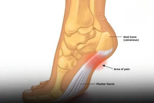 What is the disease that causes frequent numbness in the legs? What is the cause?