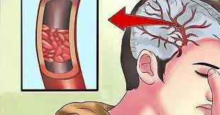 Your Body May Be Sending These 32 Magnesium Deficiency Signals