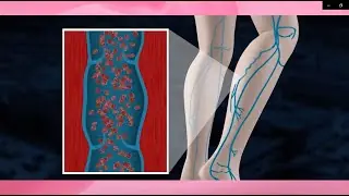 Your circulation may be weaker than you think. Here are 6 things that could help improve blood flow naturally