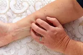 He Ignored the Itching for Weeks... Until a Medical Exam Revealed the Truth