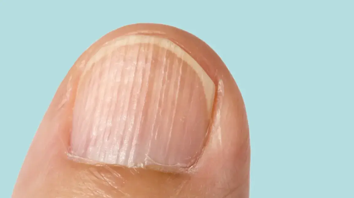 After Age 40, Your Nails May Reveal Health Clues You Shouldn't Overlook