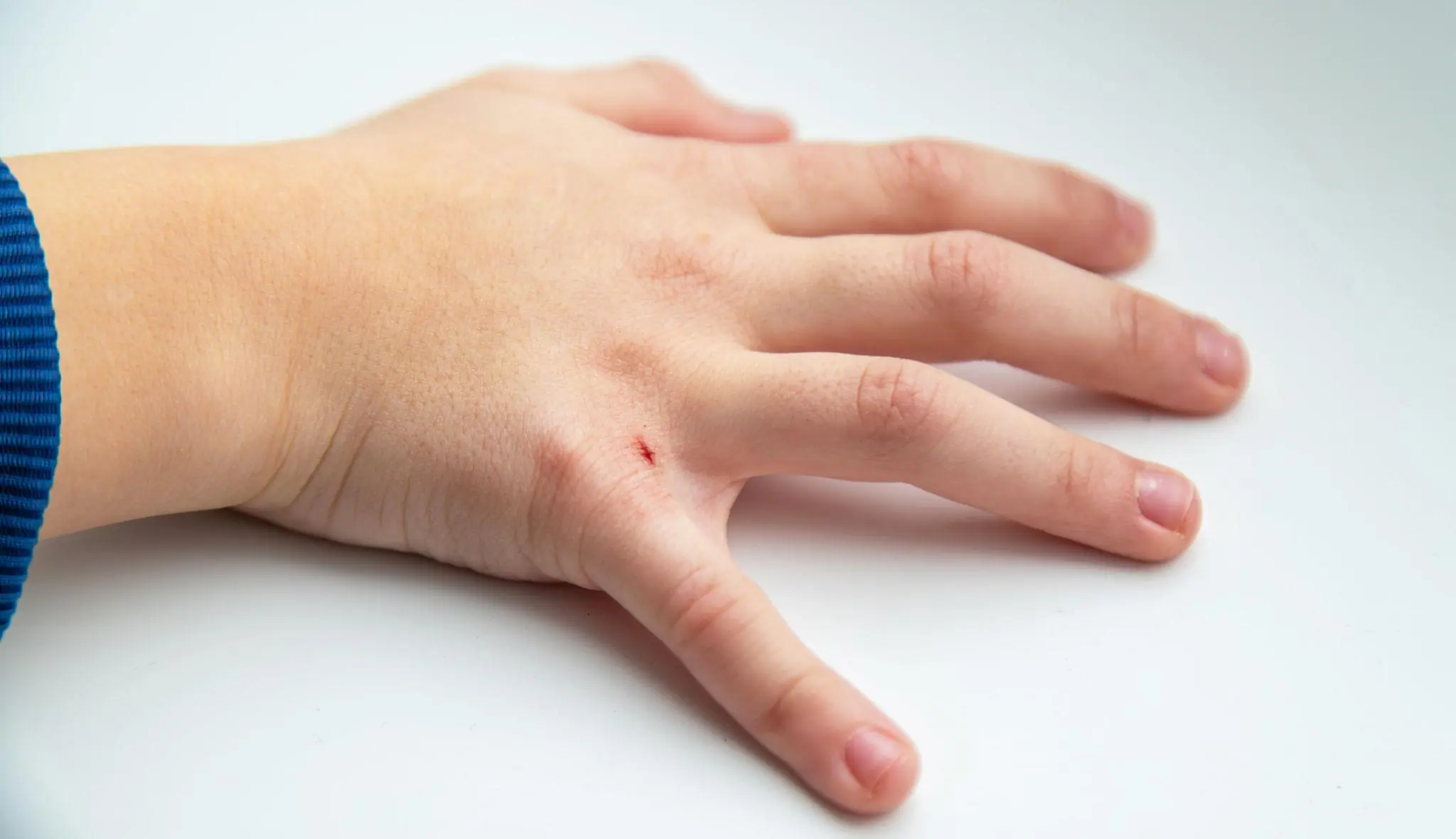 Doctors Warn: If You Have These Tiny Red Dots on Your Arm or Hand, Do Not Ignore the Warning Signs 🚨