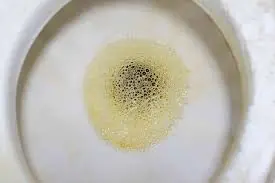 Foamy Urine Isn't Always Harmless — Here’s When You Should Pay Attention