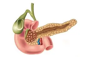 Your Body May Be Giving You Early Clues About Pancreatic Cancer — Here’s What to Know
