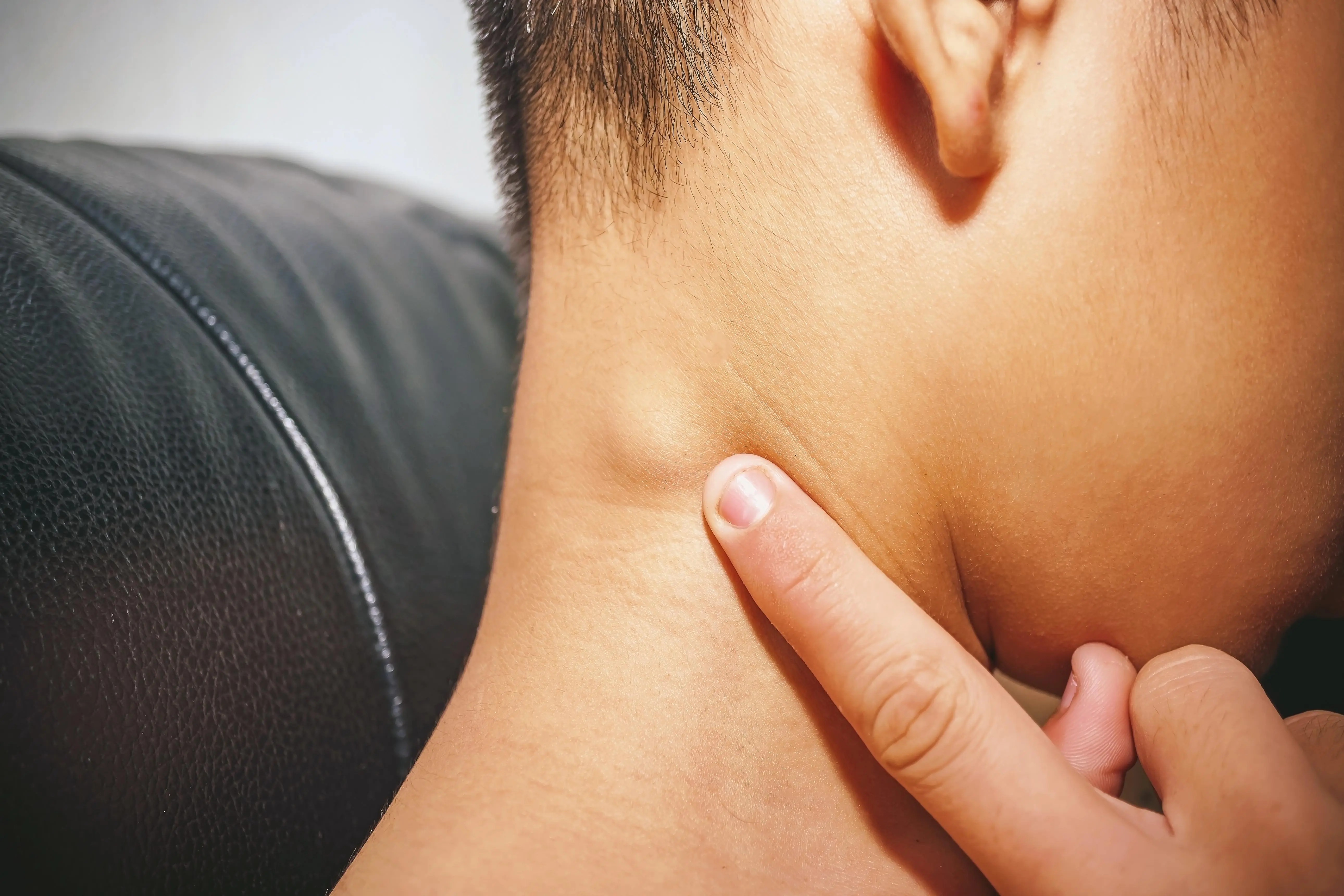 Don't Ignore Swollen Lymph Nodes in the Neck: Know the Warning Signs
