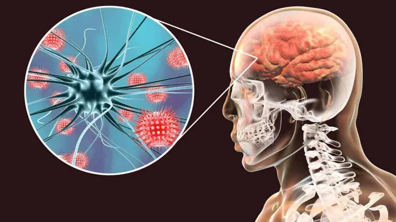 Early Detection Matters: Key Symptoms of Meningitis You Should Know