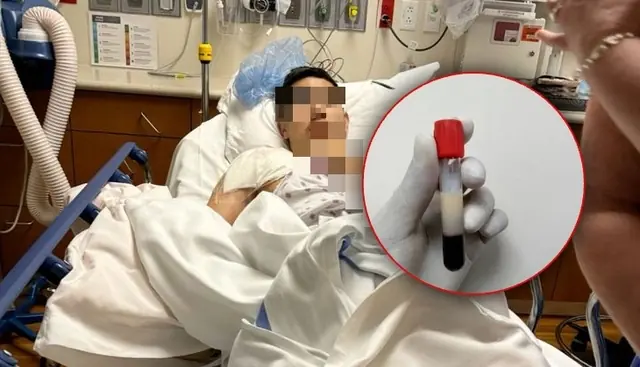 28-Year-Old Man's Blo.od Turned Milky White Like Cooking Oil: Doctors Point to Two Popular Dishes and Two Common Drinks