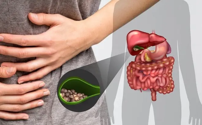 Recognizing Gallbladder Trouble Early: Symptoms You Should Pay Attention To