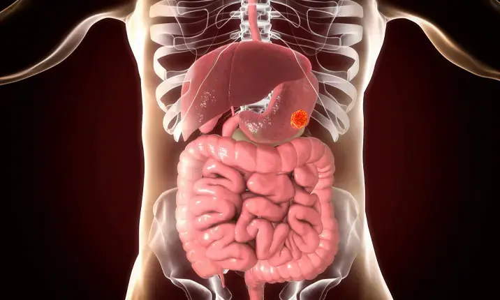 15 Potential Warning Signs of Stomach Can.cer That Deserve Your Attention