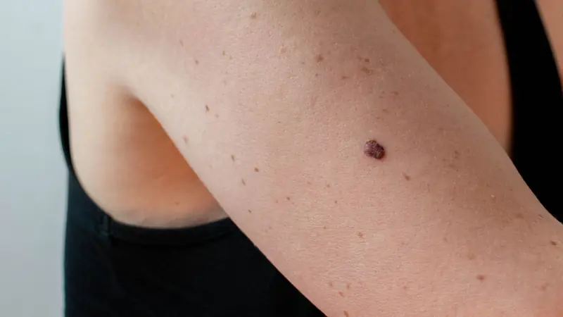 Your Body Could Be Warning You: 20 Early Signs of Can.cer You Should Never Ignore