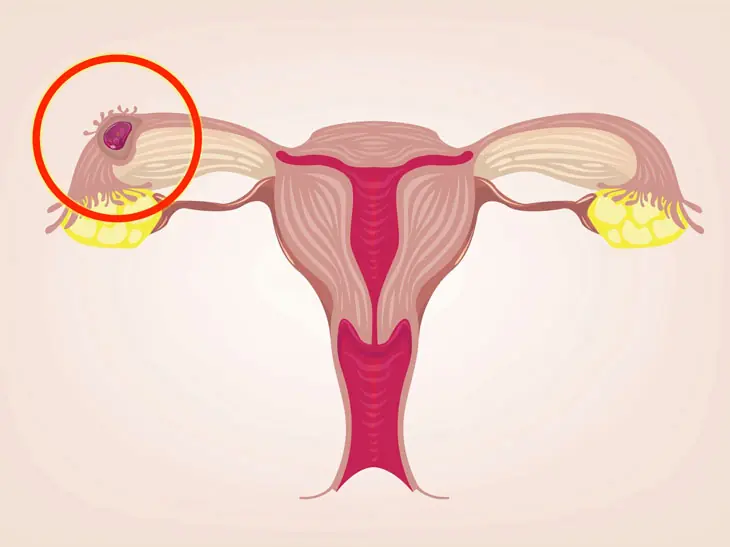 These 5 Everyday Foods Could Potentially Affect Women's Uterine Health