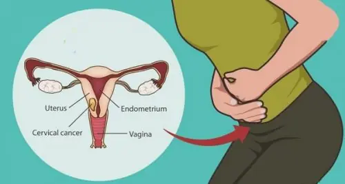 Could It Be Cervical Can.cer? Here Are 5 Signs Every Woman Should Be Aware Of