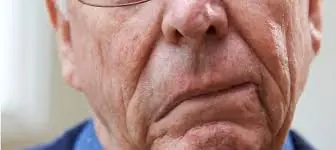 Act Fast: 5 Mini Stroke Warning Signs in Seniors You Should Never Ignore