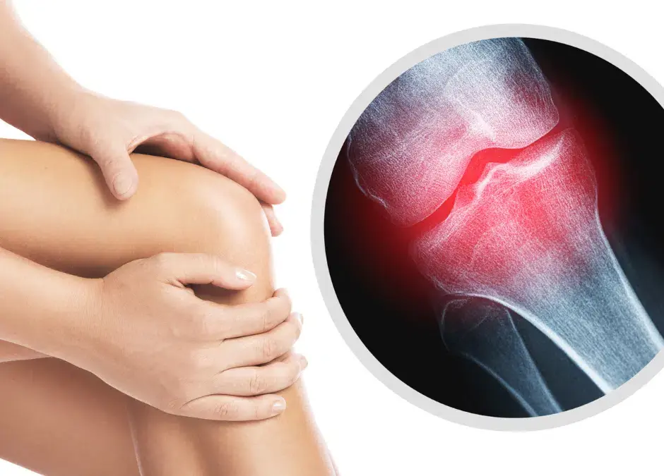 The 6 Common Foods That May Silently Drain Calcium From Your Body: Could They Be Weakening Your Bones?