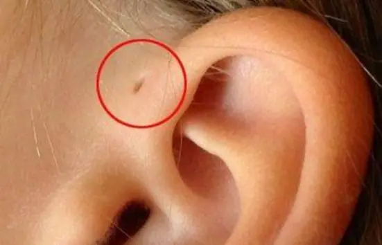Do You Know Anyone With This Ear Mark? Here's What It May Mean
