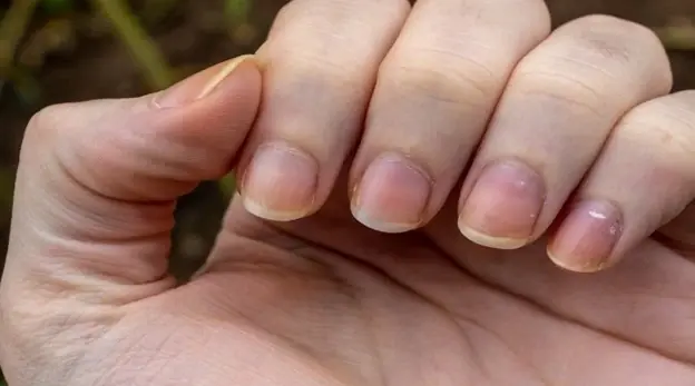 Your Nails May Be Telling You Something: 3 Signs to Watch For