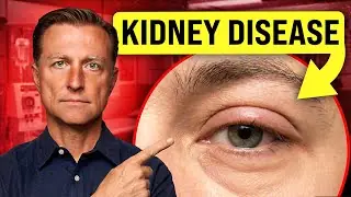 11 Surprising Symptoms That Could Mean Your Kidneys Aren't Working Properly