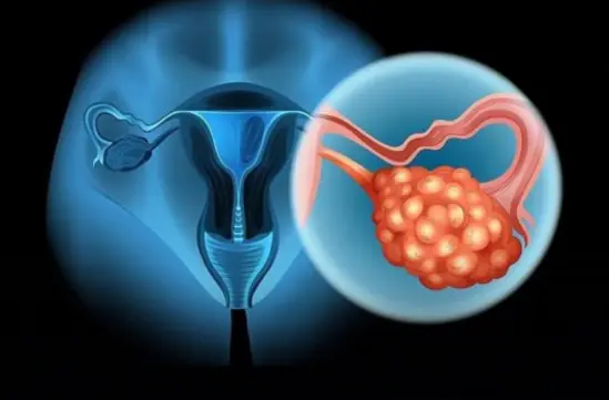 Experts Warn These 3 Intimate Habits May Increase a Woman’s Risk of Cervical Health Problems